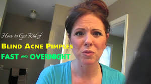 They develop when your pore, which is shaped like a long tube, branches out and causes oil to take a detour from its path to the surface of your skin. How To Get Rid Of Blind Acne Pimples Fast Overnight Stylish Walks