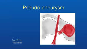 Image result for Pseudoeriosema
