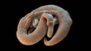 Mebendazole (trade names vermox®, ovex®) is the most commonly prescribed medicine for worms in the uk. Seventeen Volunteers Let This Worm Live Inside Them To Help Defeat A Dangerous Disease Science Aaas