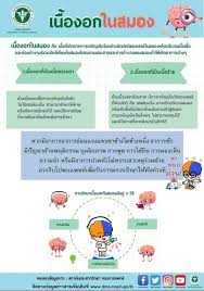 Oct 17, 2021 · โรคมะเร็งสมองในเด็กอายุต่ำกว่า 2 ขวบ ซึ่งเป็นกลุ่มเด็กที่กะโหลกศีรษะยังปิดไม่สนิท เด็กจะมาด้วยอาการกะโหลกศีรษะโต แต่ถ้าเป็นเด็กที่อายุ 2. Lf6qgpkb9le6rm