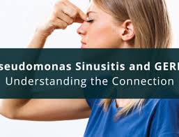 The Manual for the Medical Management of Chronic Sinusitis by Dr. Andrew  Pugliese