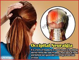 Headache affects the left hemisphere and is of a throbbing searing or piercing in nature. Occipital Neuralgia Treatment Symptoms Causes Diagnosis With Images Occipital Neuralgia Neuralgia Natural Headache Remedies