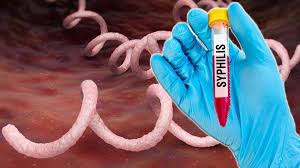 Image result for Treponema