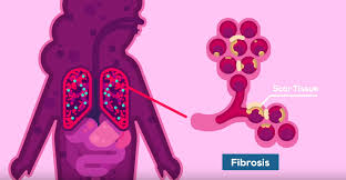 50+ animasi bergerak tema sekolah untuk powerpoint. Tonton Video Ini Untuk Mendapat Penjelasan Soal Covid 19