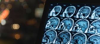 The term computed tomography, or ct, refers to a computerized. Credits For Continuing Education Ce Arrt Requirements