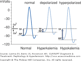 We examined the clinical scenarios and outcomes of patients who developed hyperkalemia and cardiac arrest during rapid rbc transfusion. Why Does Hyperkalemia Cause Cardiac Arrest Quora