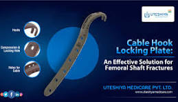 Cable Hook Locking Plate: An Effective Solution for Femoral ...