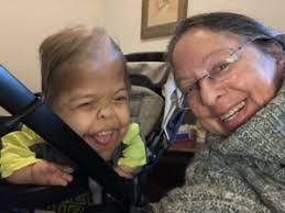 Singer Inspires The World: Special Needs Awareness