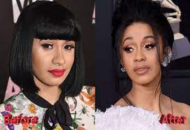 Check spelling or type a new query. Pin On Celebrity Plastic Surgery