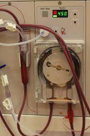 Dialysis Machine Dialysis Dialysis Machine Kidney Dialysis