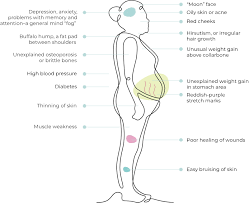 Image result for Cushing Response