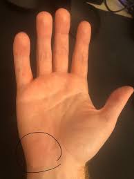 Image result for Pisiform Bone