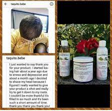 Over 48,000 clients worldwide are experiencing complete restoration from hair loss from medication, illness and ccca and the big. Formula D Hair Regrowth Serum Good For Ccca Etsy