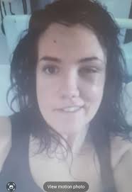 Hello, I wanted to share that I found a good pairing of therapies, I have  Dystonia and medical PTSD(trauma). I paired EMDR and Neuromuscular feedback  it made a world of difference for