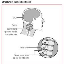 Image result for Neck Pain