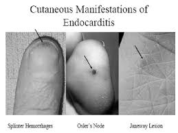 #fourtwnty #hitamputih #lelaku i do. Ontoseno Hitam Putih Mumtaz Healthcare Medical Health Mersing 8 Photos Facebook Garrettajuirn