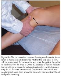 Image result for Lachman Test