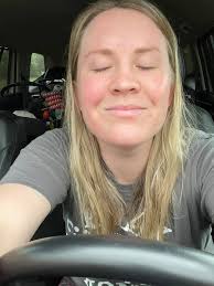 ISO A product for my face..I had a chemical peel