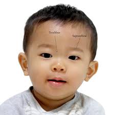 Image result for Forehead Regional Block