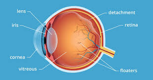Possible if you suffer from migraines. Eye Spots Floaters And Flashes All About Vision