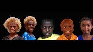 It was initially assumed that he had pale skin and fair hair until the new dna. Black People With Natural Blonde Hair And Blue Eyes Collection Youtube