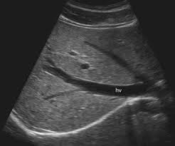 Pin By Sam Prewett On Ultrasound Ultrasound Medical Ultrasound Diagnostic Medical Sonography