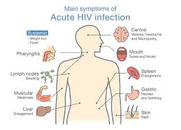 Pin On Hiv Symptoms
