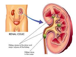 Pin On Home Remedies