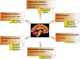 Degenerative Disease An Overview Sciencedirect Topics