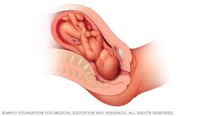 Sunny Side Up Baby Help Flip Your Infant For A Quick Easy Delivery