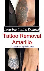 Tattoo Goo Can Laser Hair Removal Affect Tattoo How To Remove Tattoo From Skin At Home Skin Tatt Laser Hair Removal Tattoo Removal Cream Laser Tattoo Removal
