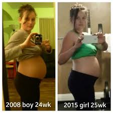 Belly Shape Gender Babycenter