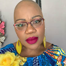 Baldness with Boldness