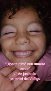 "Tus manchitas son pinceladas de amor que Dios puso en ti para que el mundo  vea lo especial que eres. Mi niña hermosa, naciste para brillar  diferente."#viralvideos #mamateama💞👩 #miniñabonita ...