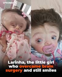 Larinha is a Brazilian girl with a story that moves thousands. She was born  with osteogenesis imperfecta, a rare disease known as “brittle bones”,  which causes frequent fractures and extreme bone fragility.
