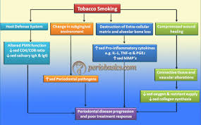 Image Result For Perio Flow Chart Health Dental Hygienist