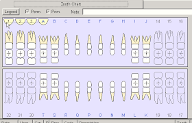 tooth chart primary vs permanent interdent it