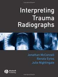 Interpreting Trauma Radiographs Kindle Edition By Mcconnell Jonathan Eyres Renata Nightingale Julie Professional Technical Kindle Ebooks Amazon Com