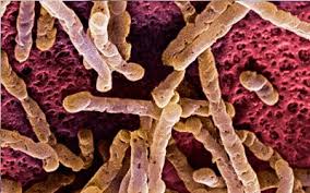 Puedo ser diabetico y no saberlo : Batido Sin Frutas Apto Para Problemas De Piel Y Candidiasis