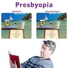 Image result for Presbyopia