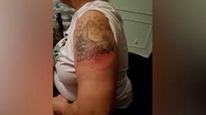 Nov 19, 2020 · how ayurvedic beverages help improve skin and beauty. Woman Experiences Side Effects Of Covid 19 Vaccine Klbk Kamc Everythinglubbock Com