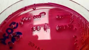 Image result for Pycnobotrya