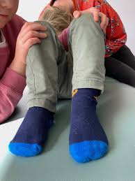 Image result for Galeazzi Sign