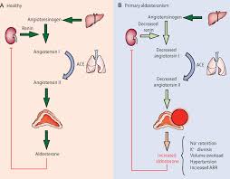 Image result for Hyperaldosteronism