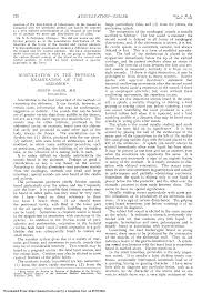 Image result for Succussion Splash