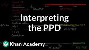 Pixels per degree, a measure of the resolution of a display screen as seen from an angle. Interpreting The Ppd Infectious Diseases Nclex Rn Khan Academy Youtube