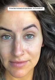 How to Apply Frownies Around Mouth: Smile Line Prevention Tutorial