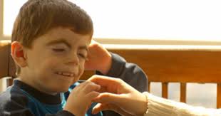 Cornelia de Lange Syndrome: Andrew's Story