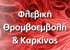 Μία σχετικά ύπουλη και επικίνδυνη νόσος. Flebikh 8romboembolh Kai Karkinos K E F I Syllogos Karkinopa8wn E8elontwn Filwn Iatrwn A8hnwn