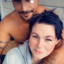 Hair falling out after bariatric surgery?